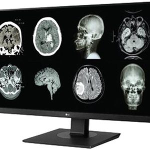 Monitor LG clínico de Revisión 27"